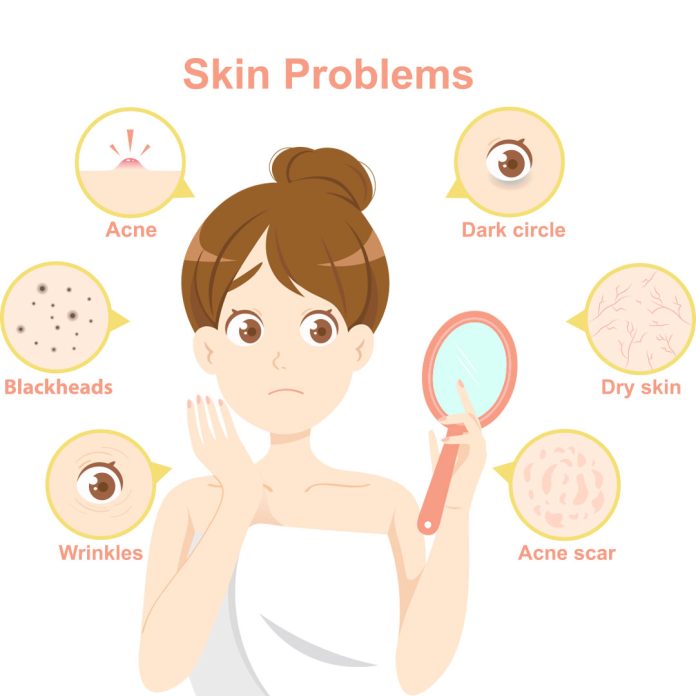 skin peel treatment,