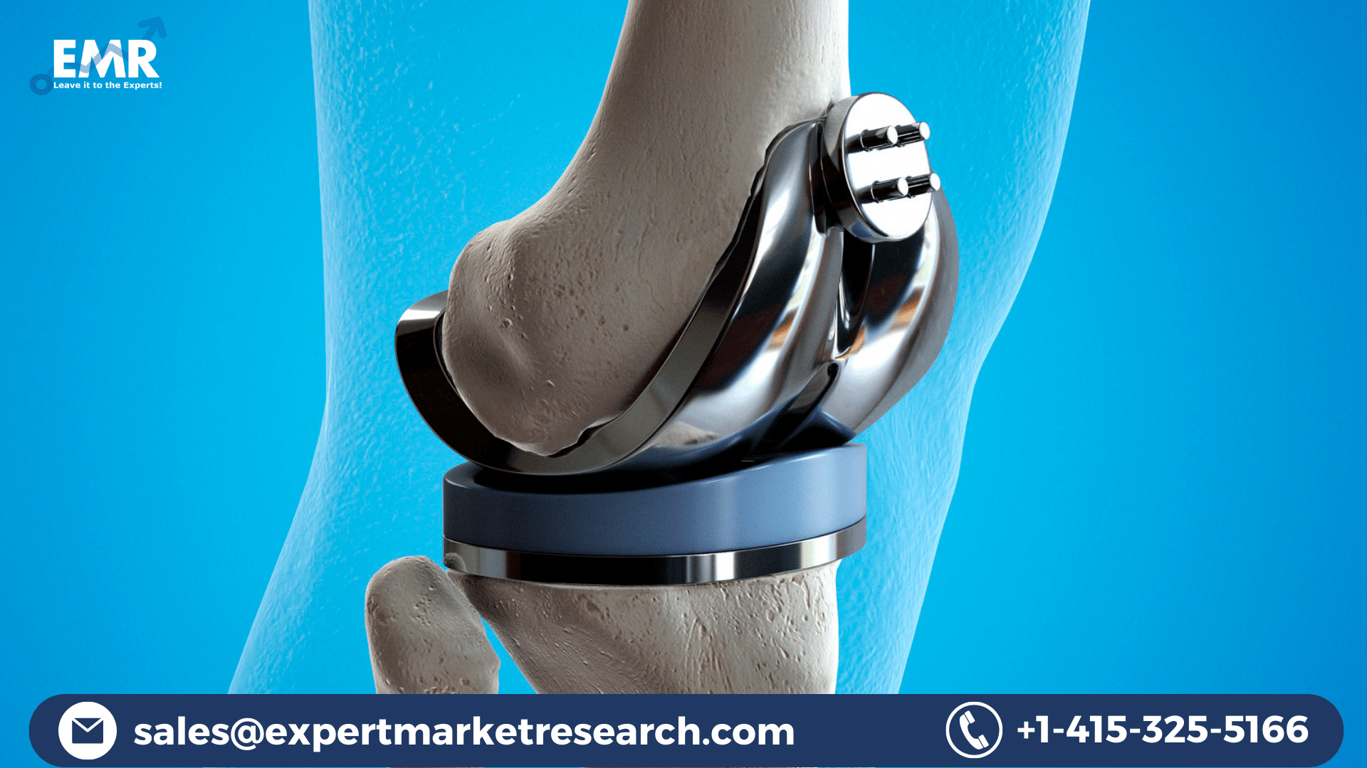 Orthopaedic Implants Market