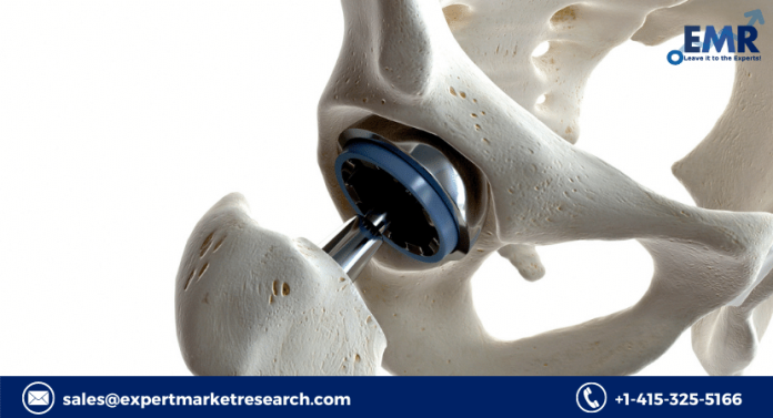 Veterinary Orthopaedic Implants Market