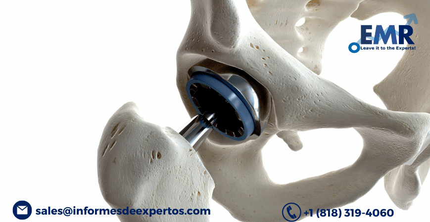Latin America Orthopaedic Implants Market