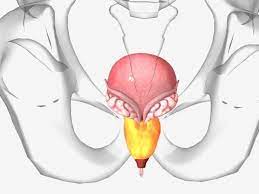 Prostate infection