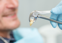 Navigating Feline Dental Health: Understanding Cat Tooth Extraction Costs Navigating Feline Dental Health Understanding Cat Tooth Extraction Costs